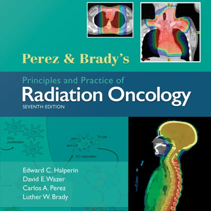 Perez & Brady's Principles and Practice of Radiation Oncology