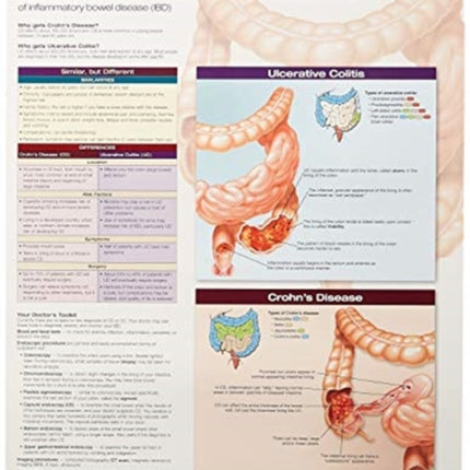 Ulcerative Colitis  Crohns Disease Anatomical