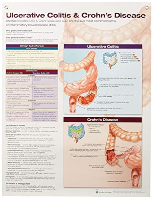 Ulcerative Colitis  Crohns Disease Anatomical