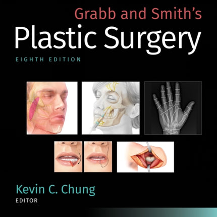 Grabb and Smith's Plastic Surgery