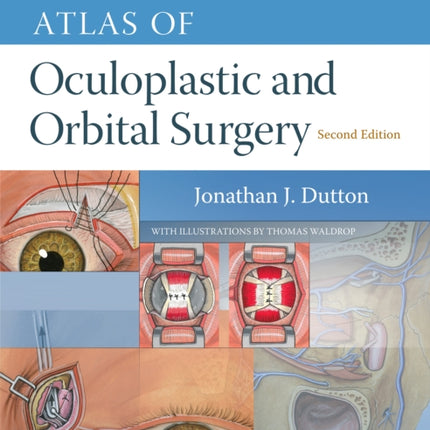 Atlas of Oculoplastic and Orbital Surgery