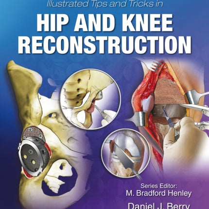 Illustrated Tips and Tricks in Hip and Knee Reconstructive and Replacement Surgery