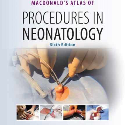 MacDonald's Atlas of Procedures in Neonatology