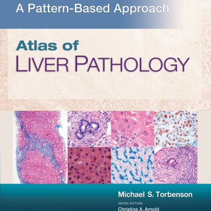 Atlas of Liver Pathology: A Pattern-Based Approach