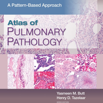 Atlas of Pulmonary Pathology: A Pattern Based Approach