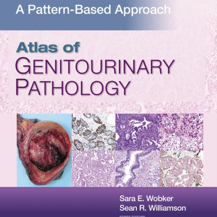 Atlas of Genitourinary Pathology: A Pattern Based Approach