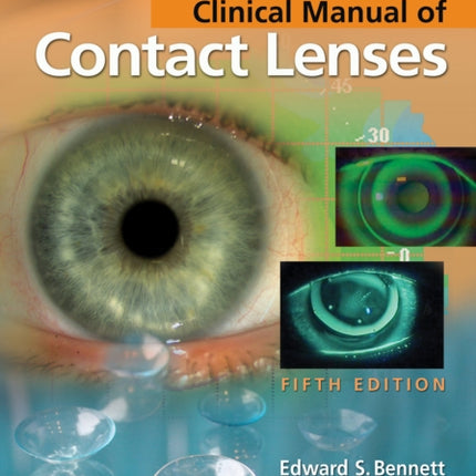 Clinical Manual of Contact Lenses