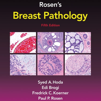 Rosen's Breast Pathology