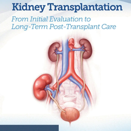 Quick Guide to Kidney Transplantation