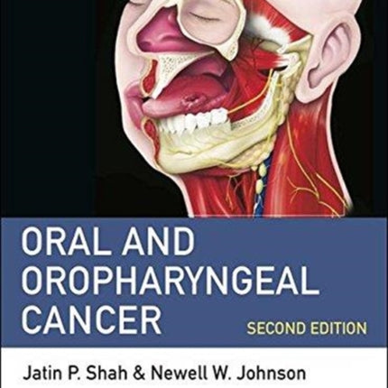 Oral and Oropharyngeal Cancer