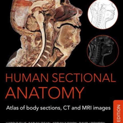 Human Sectional Anatomy: Atlas of Body Sections, CT and MRI Images, Fourth Edition