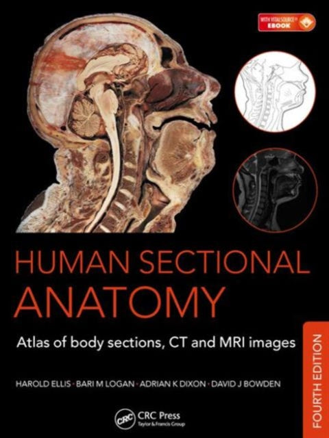 Human Sectional Anatomy: Atlas of Body Sections, CT and MRI Images, Fourth Edition