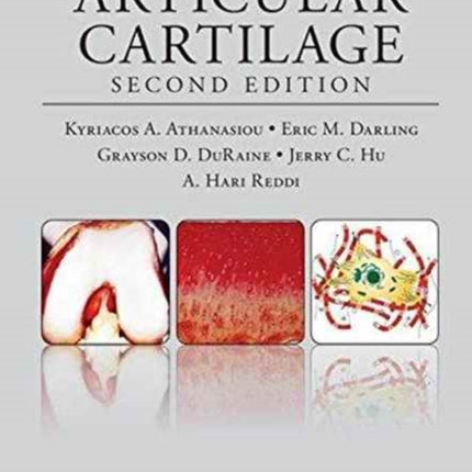 Articular Cartilage