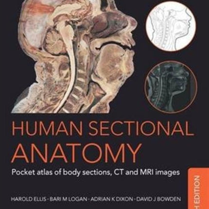 Human Sectional Anatomy: Pocket atlas of body sections, CT and MRI images, Fourth edition