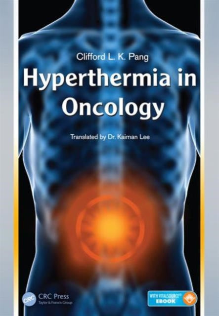 Hyperthermia in Oncology