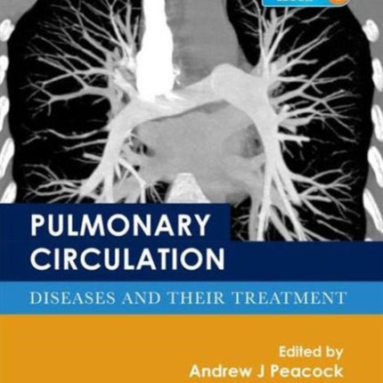 Pulmonary Circulation: Diseases and Their Treatment, Fourth Edition