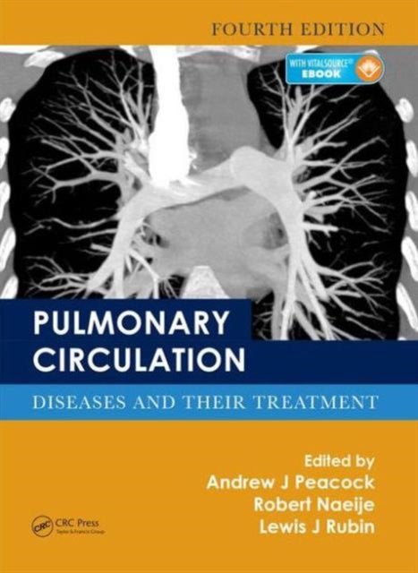 Pulmonary Circulation: Diseases and Their Treatment, Fourth Edition