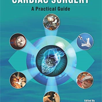 Minimally Invasive Cardiac Surgery: A Practical Guide