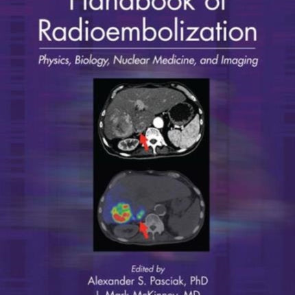 Handbook of Radioembolization: Physics, Biology, Nuclear Medicine, and Imaging