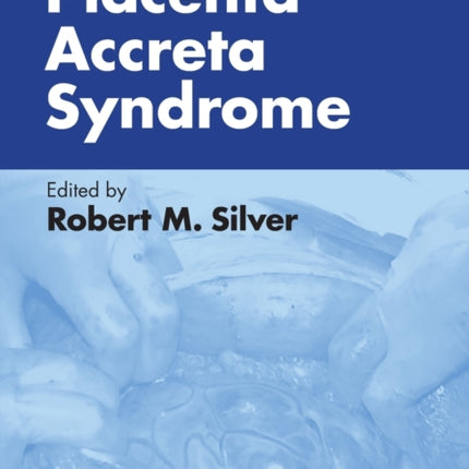 Placenta Accreta Syndrome