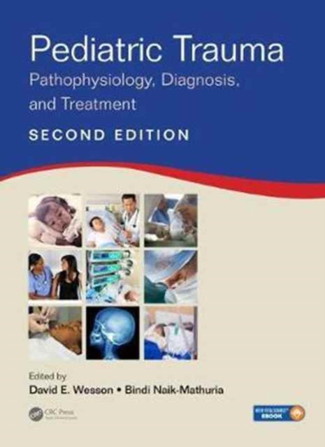 Pediatric Trauma: Pathophysiology, Diagnosis, and Treatment, Second Edition