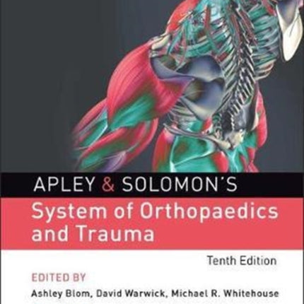 Apley & Solomon's System of Orthopaedics and Trauma