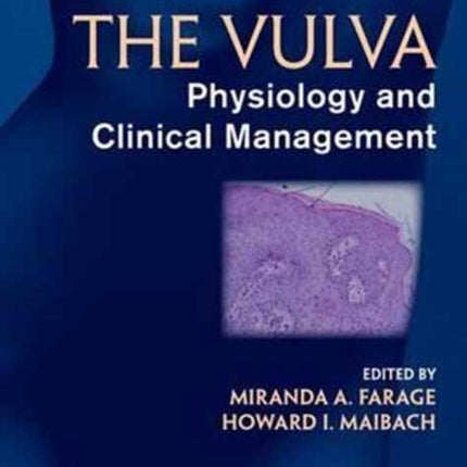 The Vulva: Physiology and Clinical Management, Second Edition