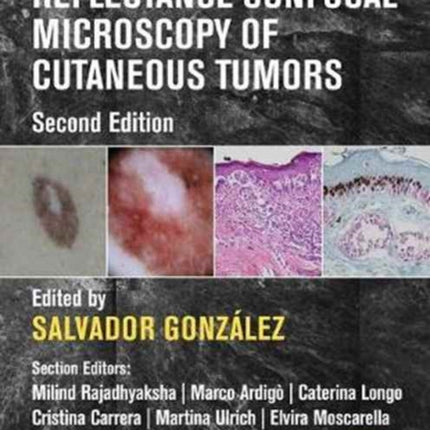 Reflectance Confocal Microscopy of Cutaneous Tumors