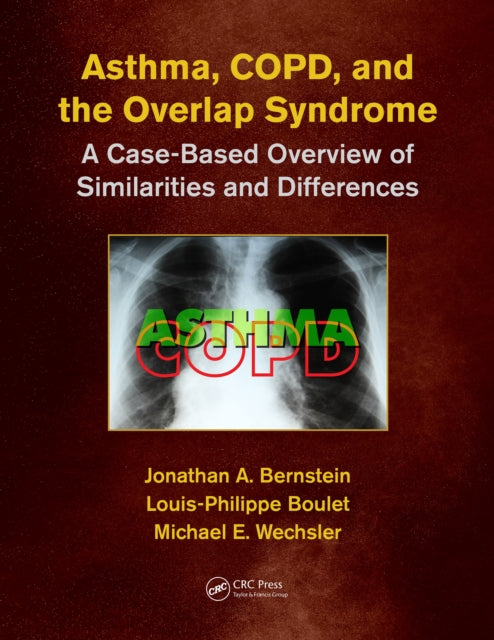 Asthma, COPD, and Overlap: A Case-Based Overview of Similarities and Differences