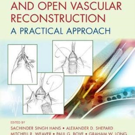 Endovascular and Open Vascular Reconstruction: A Practical Approach