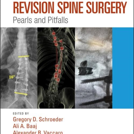 Revision Spine Surgery: Pearls and Pitfalls