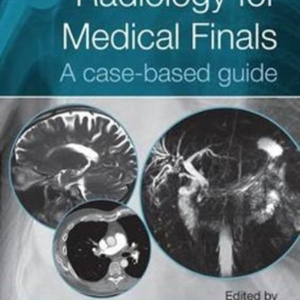 Radiology for Medical Finals: A case-based guide