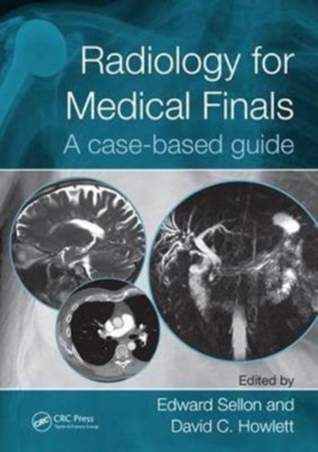 Radiology for Medical Finals: A case-based guide