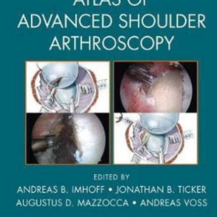 Atlas of Advanced Shoulder Arthroscopy