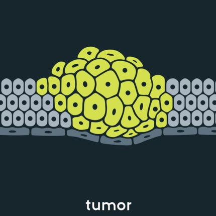 Tumor