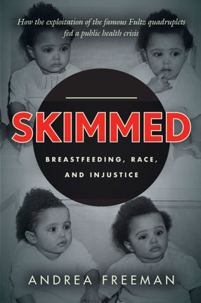 Skimmed: Breastfeeding, Race, and Injustice