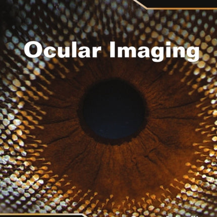 Ocular Imaging, Volume 5: Lectures in Optics