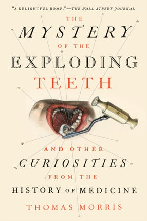 The Mystery of the Exploding Teeth: And Other