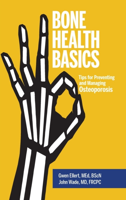 Bone Health Basics: Tips for Preventing and Managing Osteoporosis