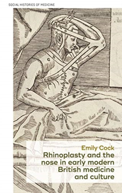 Rhinoplasty and the Nose in Early Modern British