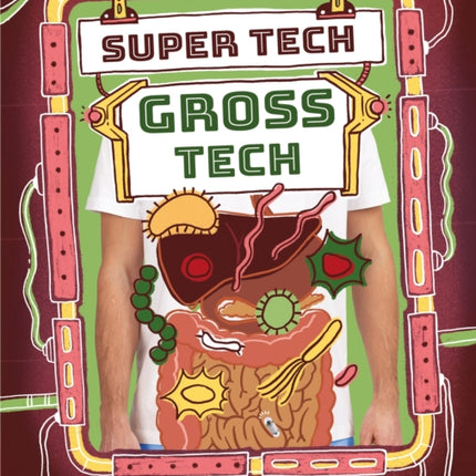 Super Tech Gross Tech