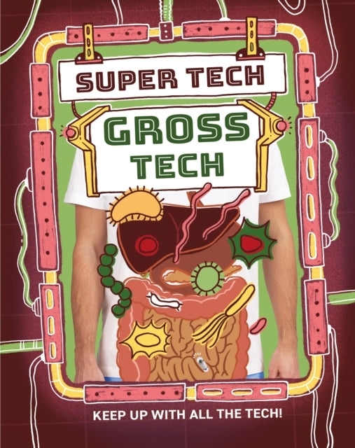 Super Tech Gross Tech