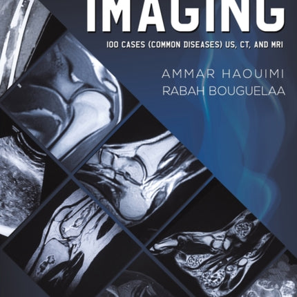 Musculoskeletal Imaging: 100 Cases (Common Diseases) US, CT and MRI