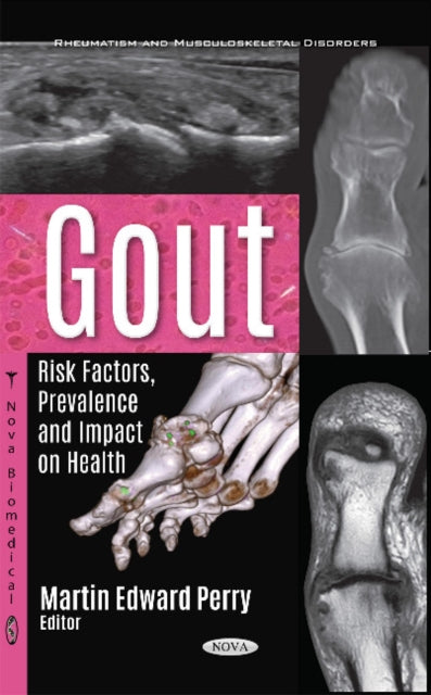 Gout: Risk Factors, Prevalence & Impact on Health