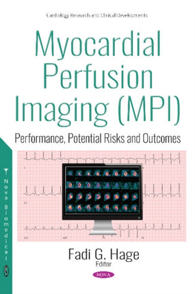 Myocardial Perfusion Imaging (MPI): Performance,