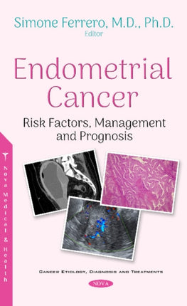 Endometrial Cancer: Risk Factors, Management and Prognosis