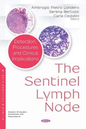 The Sentinel Lymph Node: Detection, Procedures