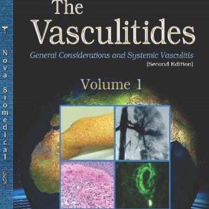 The Vasculitides: Volume 1 -- General Considerations and Systemic Vasculitis