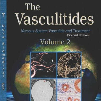 The Vasculitides: Volume 2 -- Nervous System Vasculitis and Treatment