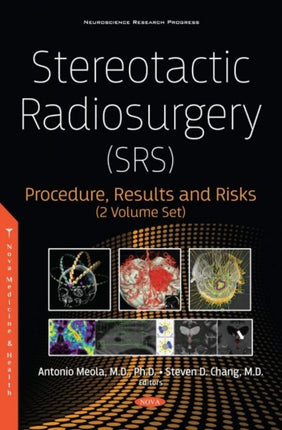 Stereotactic Radiosurgery (SRS): Procedure, Results and Risks (2 Volume Set)